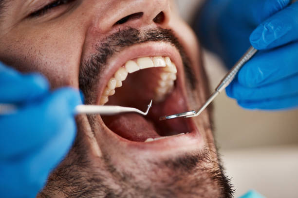 Best Broken Tooth Emergency  in Lincolnshire, IL